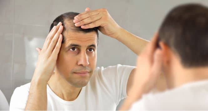 HairPros Review: Does It Help Treat Baldness or Hair Loss?0 (0)