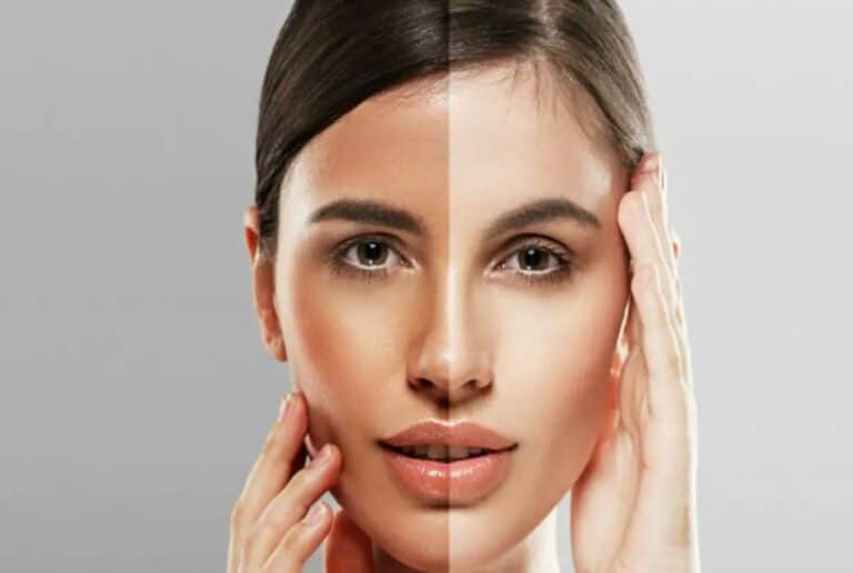 Skin Whitening Forever Review: Does It Help In Brightening Your Complexion?0 (0)
